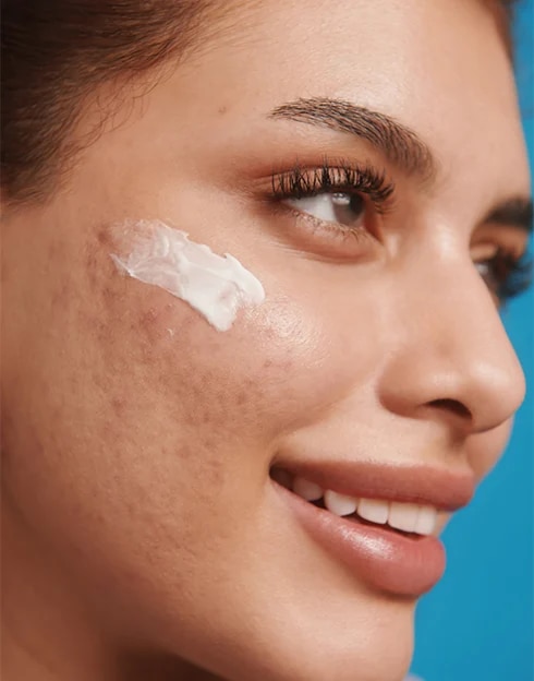 sephora = breakout &blemish